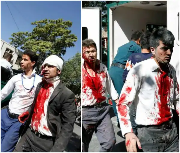 80 killed, hundreds wounded in car bomb blast in Afghanistan (Graphic Photos)